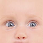¿Qué es la conjuntivitis neonatal?