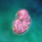 Desarrollo fetal: primer trimestre