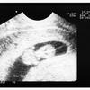 Desarrollo fetal