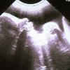 Desarrollo fetal