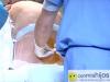 Vídeo sobre la anestesia epidural durante el parto