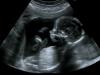 Vídeo del tercer mes de embarazo