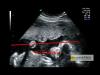El desarrollo del bebé en el séptimo mes de embarazo en vídeo