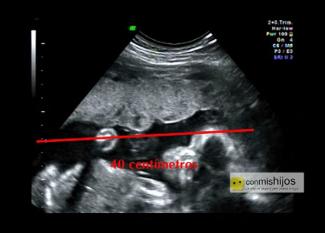 El desarrollo del bebé en el séptimo mes de embarazo en vídeo