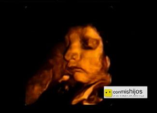 El desarrollo del bebé en el octavo mes de embarazo en vídeo