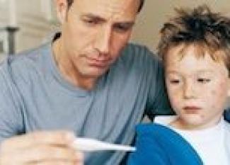 Enfermedades comunes del niño: varicela