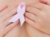 Cáncer de mama, síntomas y tratamiento de la enfermedad