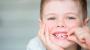 Cuándo se caen los dientes de leche de los niños y en qué orden