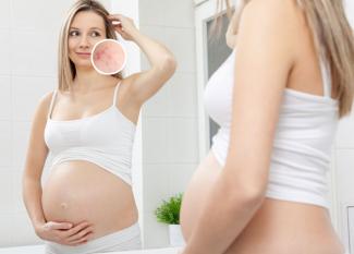 Acné en el embarazo: por qué aparecen granos y cómo tratarlos