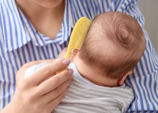 Cómo eliminar las costras lácteas del bebé