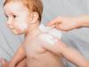 dermatitis en bebés