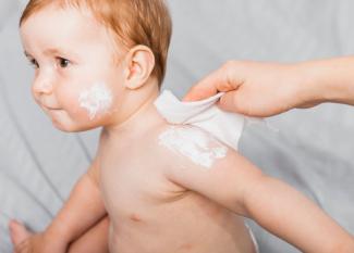 dermatitis en bebés