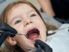 errores en la higiene bucodental de los niños