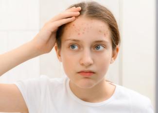 disruptores hormonales