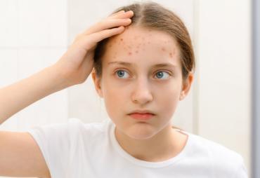 Lo que puede alterar las hormonas de tus hijos y seguramente tienes en casa