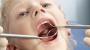 Caries en niños y niñas