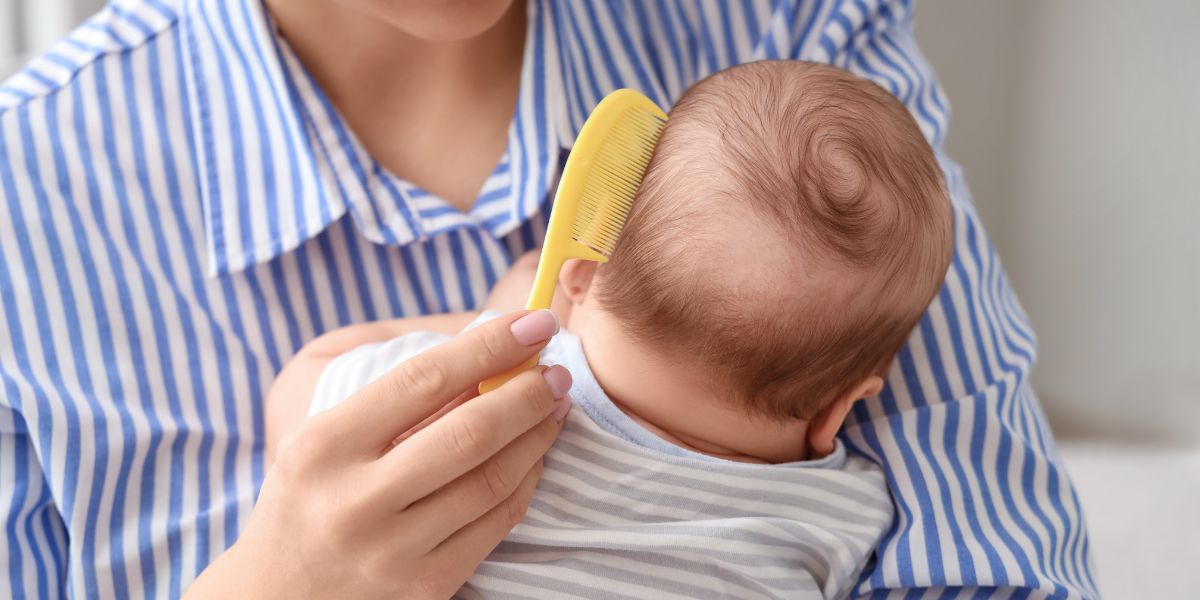 Cómo eliminar las costras lácteas del bebé