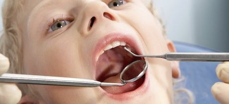 La caries en tu hijo