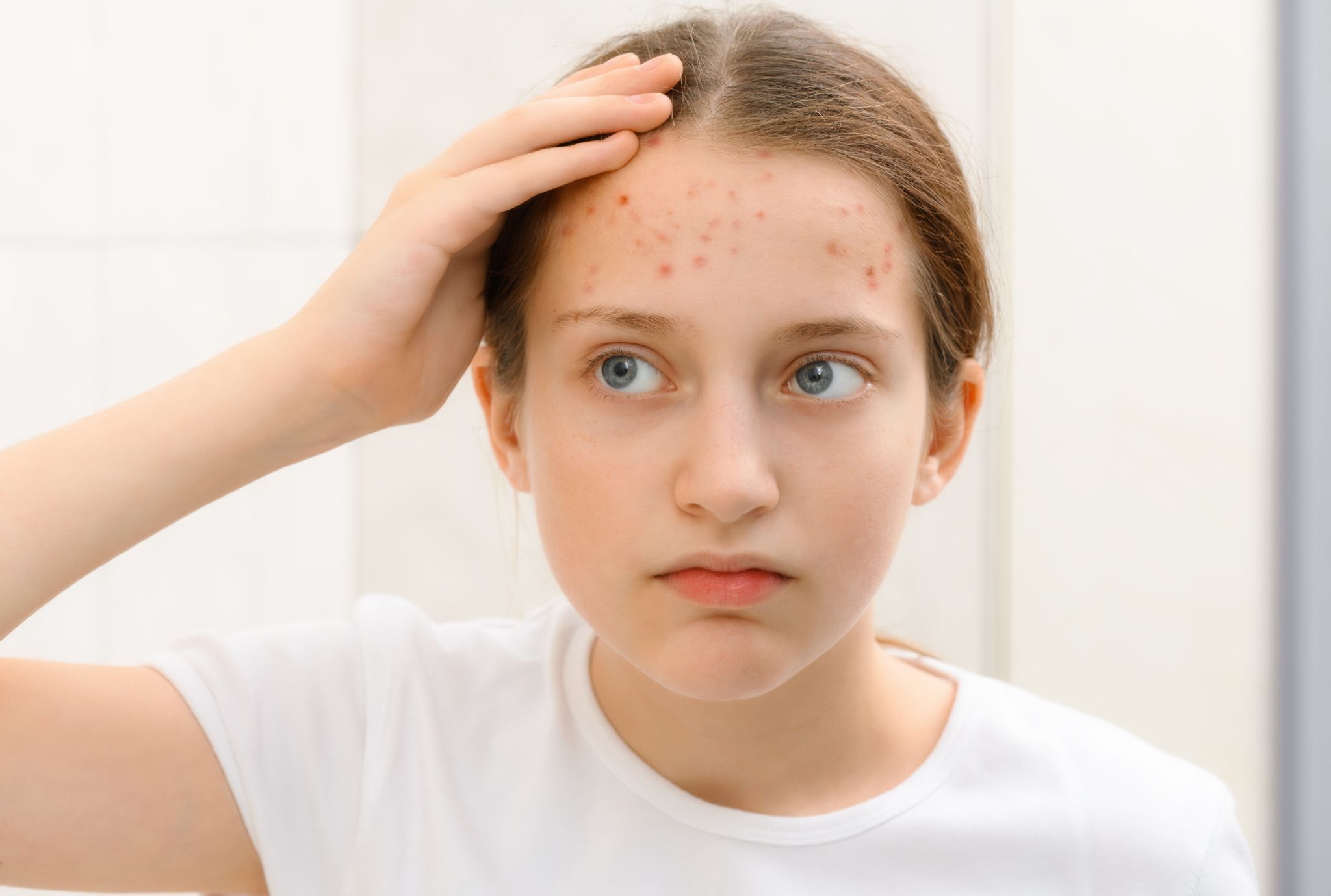 disruptores hormonales