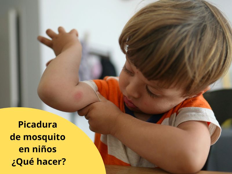 remedios para las picaduras de mosquitos en niños