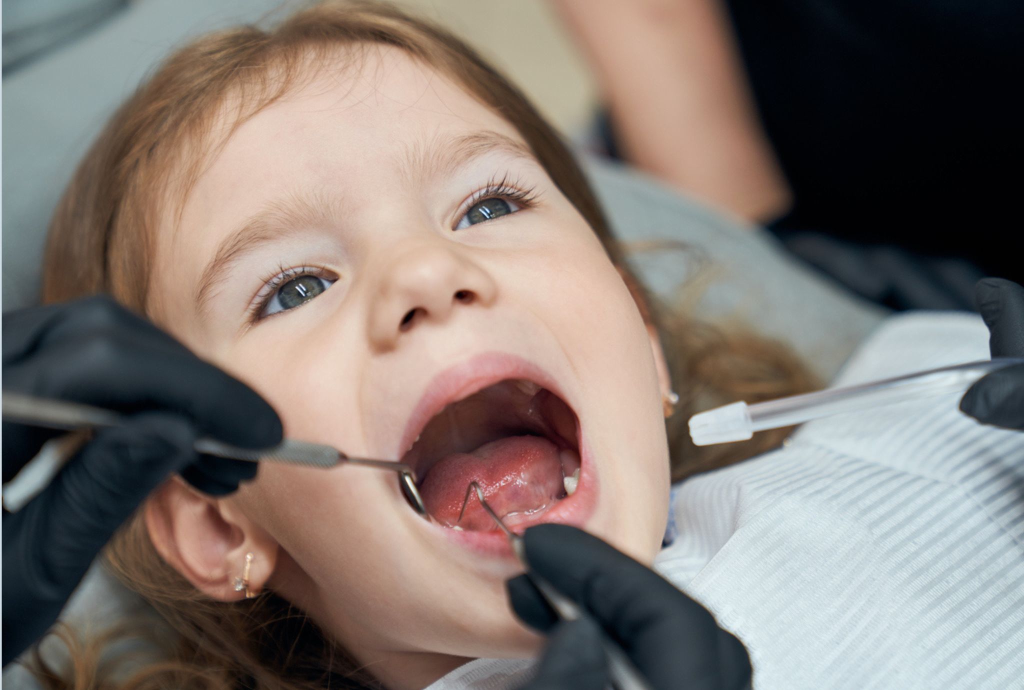 errores en la higiene bucodental de los niños